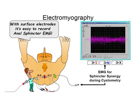 scratch test bladder|electromyography for bladder function.